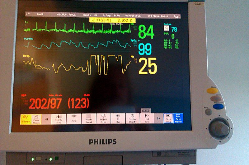 hospital vital signs monitor