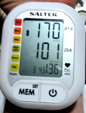 very high pulse rate